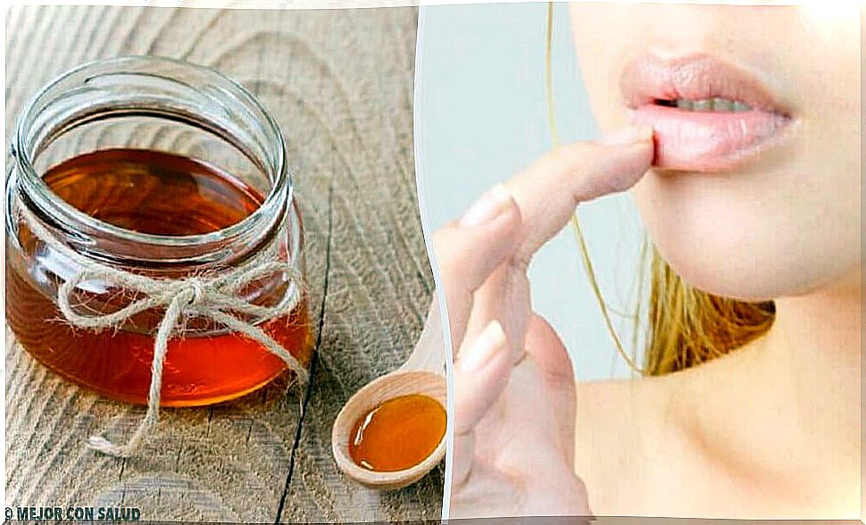 6 Natural Remedies for Lip Cracks