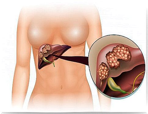 Apples favor liver function