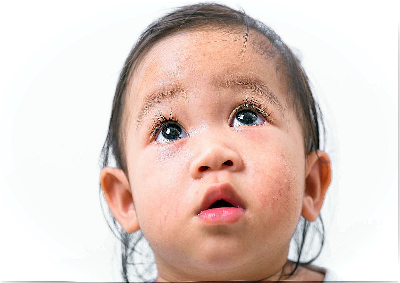 Skin blemishes on children's faces