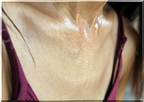 How to treat underarm sweat