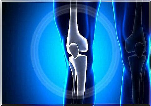 What is osteosarcoma?