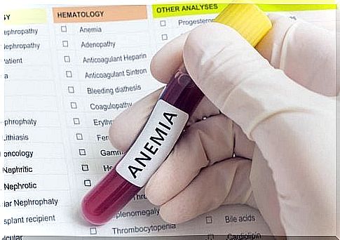 Blood test to detect anemia