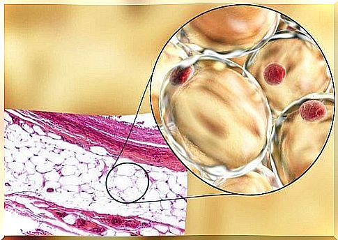 Adiponectin